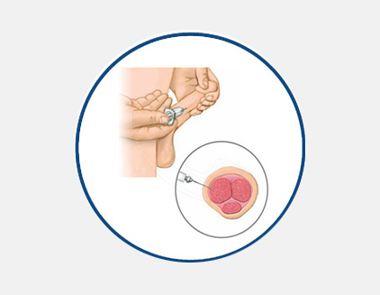 hf_treatment